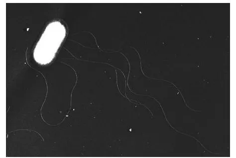 図1 腸管出血性大腸菌O157:H7の電子顕微鏡写真（15,000倍）（出典：国立感染症研究所ホームページ）