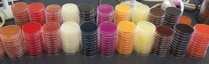 食中毒検査に使用する寒天培地