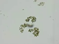 ミクロキスティス（筑後地方のため池）