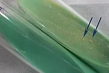 図1 培養された結核菌