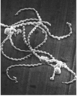 Leptospira interrogansの電子顕微鏡写真